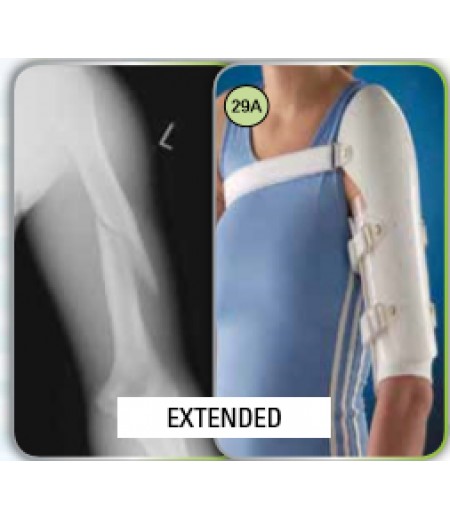 HUMERAL FRACTURE BRACE (EXTENDED/SHORT) & FOREARM FRACTURE BRACE